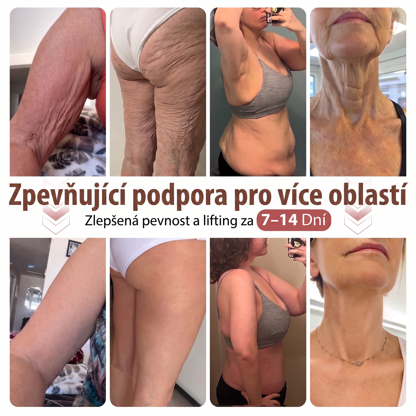 💬HISKIN® Mikroneedlová náplast pro podporu objemu, lifting a pevnost prsou