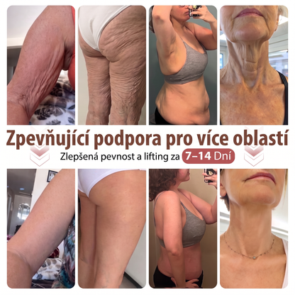 💬HISKIN® Mikroneedlová náplast pro podporu objemu, lifting a pevnost prsou