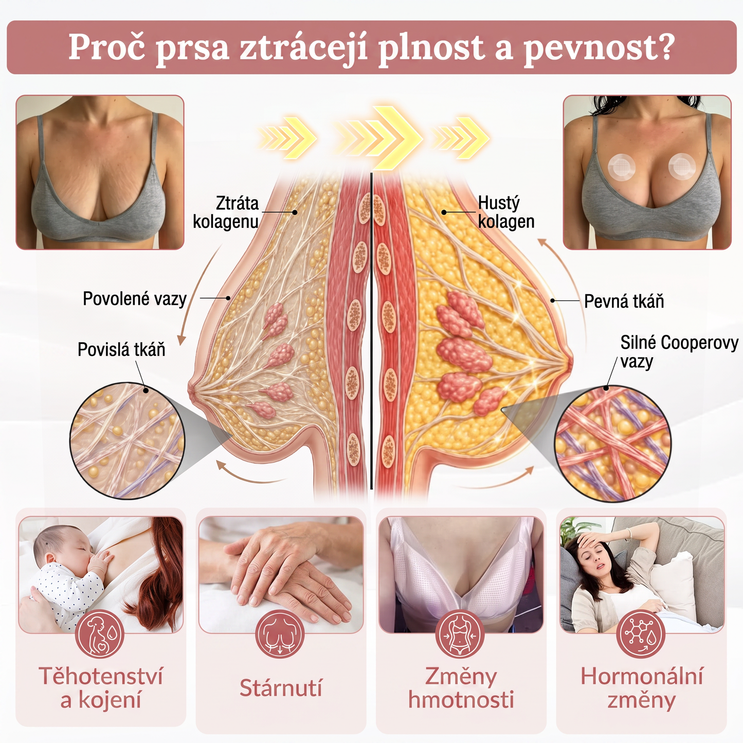 💬HISKIN® Mikroneedlová náplast pro podporu objemu, lifting a pevnost prsou